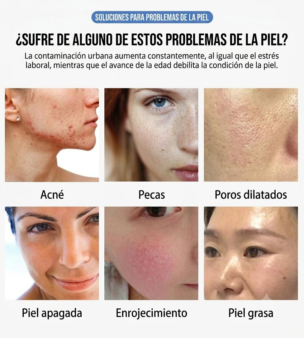 LumiFace - Rejuvenece tu Piel en Casa con Luz LED